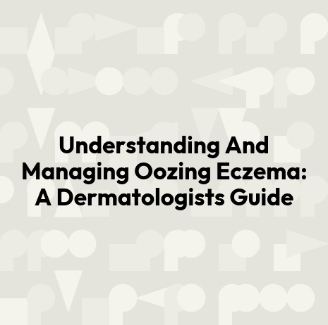 Understanding And Managing Oozing Eczema: A Dermatologists Guide