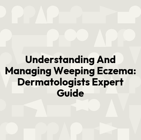 Understanding And Managing Weeping Eczema: Dermatologists Expert Guide