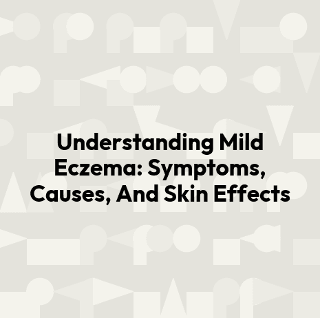 Understanding Mild Eczema: Symptoms, Causes, And Skin Effects