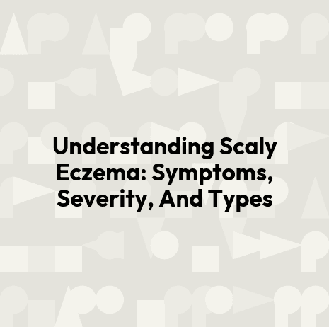 Understanding Scaly Eczema: Symptoms, Severity, And Types