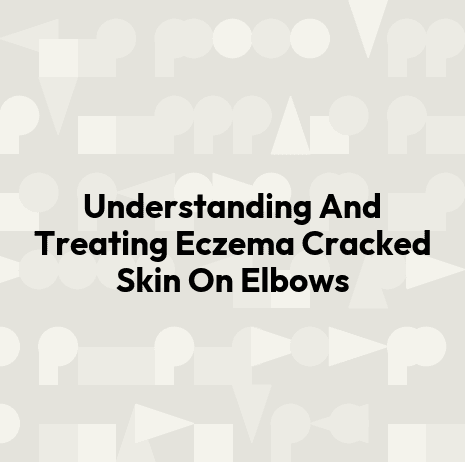 Understanding And Treating Eczema Cracked Skin On Elbows