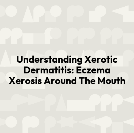 Understanding Xerotic Dermatitis: Eczema Xerosis Around The Mouth