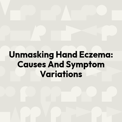 Unmasking Hand Eczema: Causes And Symptom Variations