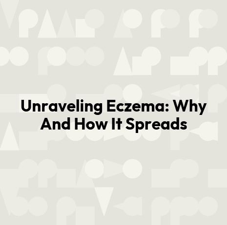 Unraveling Eczema: Why And How It Spreads