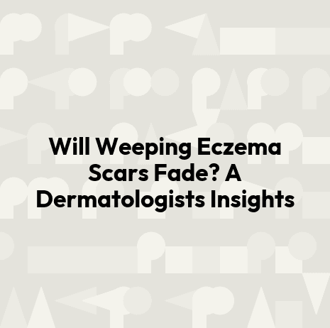 Will Weeping Eczema Scars Fade? A Dermatologists Insights